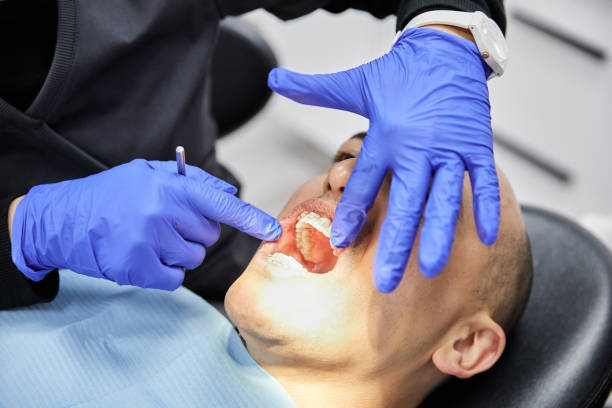 Best Urgent Care for Lost Fillings or Crowns in Spring Valley, CA